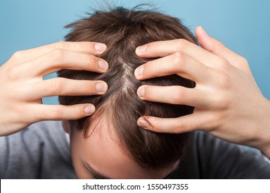 Closeup Of Young Man Holding Hair With Hands, Showing Clean Scalp And Washed Brown Healthy Hair Without Dandruff, Shampoo And Rinse For Male Skincare. Indoor Studio Shot Isolated On Blue Background