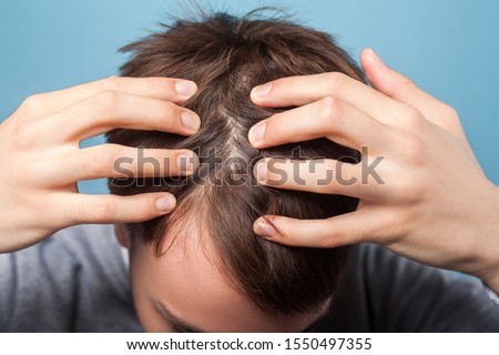 Closeup of young man holding hair with hands, showing clean scalp and washed brown healthy hair without dandruff, shampoo and rinse for male skincare. indoor studio shot isolated on blue background