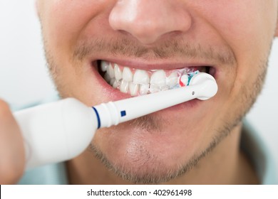 Close-up Of Young Man Teeth With Electric Toothbrush