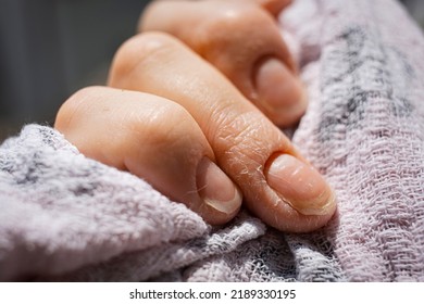 Close-up of a young mother's hand with Beau lines on ring finger - Shutterstock ID 2189330195