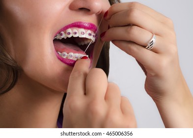 Closeup Of Young Woman With Braces Flossing Teeth