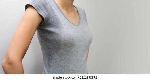 Close-up Of A Young Woman In A Gray Shirt With Hyperhidrosis, Sweating. Young Caucasian Woman With Sweat Stains On Gray Clothes On A Light Background. Concept Of Healthcare.