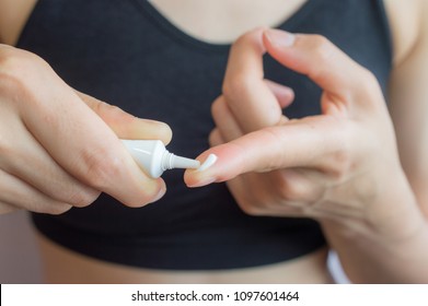 Close-up Of Young Woman Having Acne Problem And She Trying To Squeeze Acne Cream From Cosmetic Tube For Solving Her Problem. Conceptual Of Woman And Cosmetic Cream.