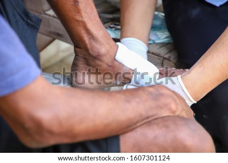Closing the gauze after washing the feet is done by the doctor's hand, wearing white long gloves.