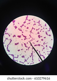 Clostridium Botulinum,bacteria Gram Positive,microscope,science,bacteria,science Lab,lab,biology,microbiology,cell,spore,toxin