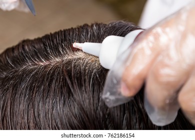 Closu-up Of Hair Dresser Applying Chemical Hair Color Dye Onto Hair Roots In Salon