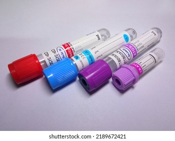 Clot Activator Tube, Sodium Citrate Tube, Standard EDTA Tube, Small EDTA Tube