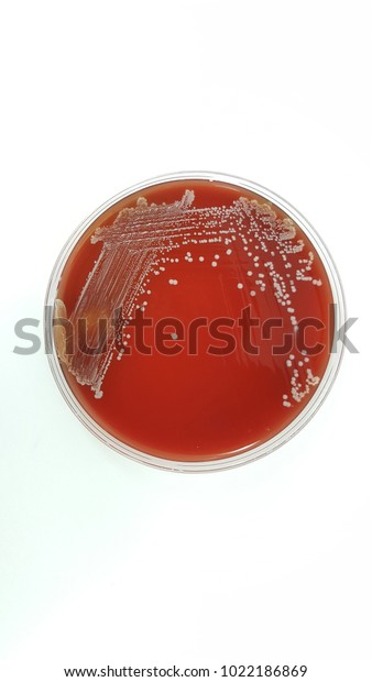 Coagulasenegative Staphylococci Blood Agar Plate Clipping Stock Photo ...