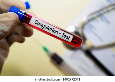 2,308 Blood coagulation Stock Photos, Images & Photography | Shutterstock