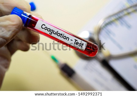 Coagulation - Test with blood sample. Top view isolated on office desk. Healthcare/Medical concept