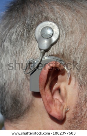 cochlea implant close up, therapy, hearing