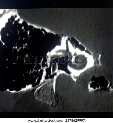 The  cochlea and semicircular canals appear normal. Theke right  mastoid air cells appear well pneumatized and left mastoid air cells not well pneumatized.