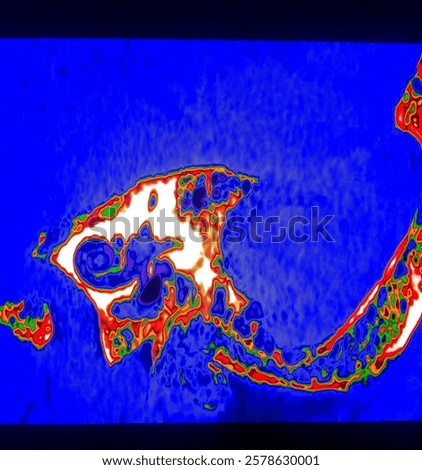 The  cochlea and semicircular canals appear normal. Theke right  mastoid air cells appear well pneumatized and left mastoid air cells not well pneumatized.