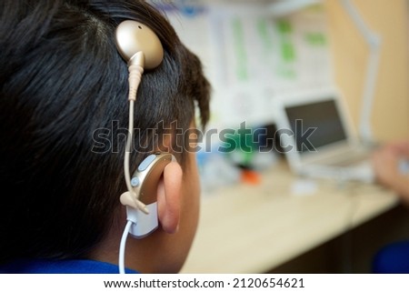 Cochlear implant on the head
