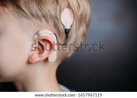 cochlear implant on the boy’s head. hearing aid.MED-EL. copy space