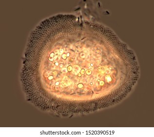 Cochliopodium, Amoeba Coated With A Layer Of Small Scales Made Visible Using Phase Contrast Microscopy. Living. Single Celled Organisms.