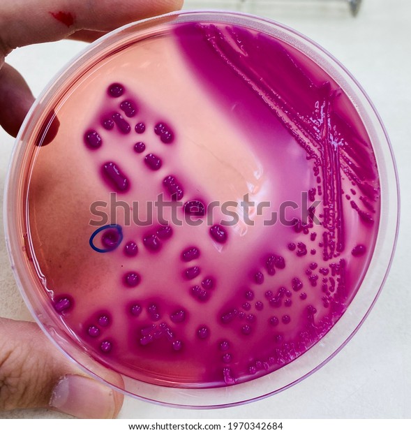 Coliform On Macconkey Agar Red Coloines Stock Photo 1970342684 ...