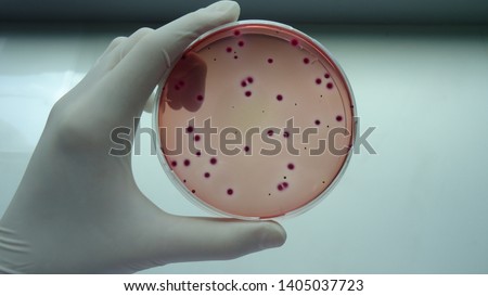 coliforms Bacteria on VRB agar