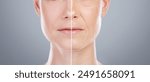 Collage, before after and face of woman for skincare, anti aging and beauty with surgery in studio. Female model, transformation and makeover with treatment, dermatology and change by gray background