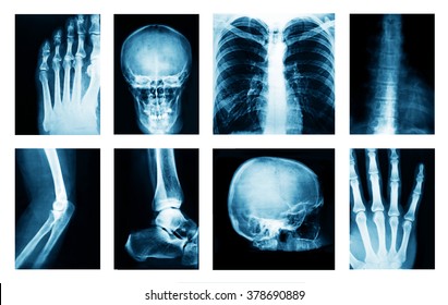 290 Xray collage Images, Stock Photos & Vectors | Shutterstock