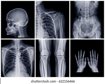 290 Xray collage Images, Stock Photos & Vectors | Shutterstock