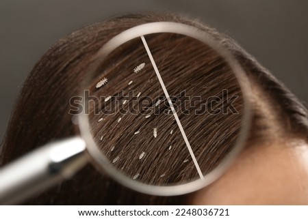 Collage showing woman's hair before and after lice treatment on grey background, closeup. View on parasitic insect through magnifying glass. Suffering from pediculosis