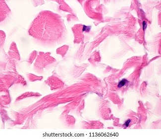 Collagen Fibers Arranged Forming Large Bundles In The Dense Irregular Connective Tissue Of Reticular Dermis