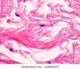 Collagen Fibers Arranged Forming Large Bundles In The Dense Irregular Connective Tissue Of Reticular Dermis