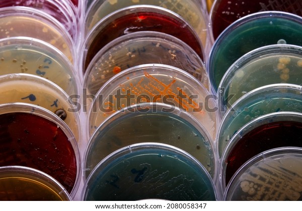 collection of culture plates contain growth of\
microorganisms on different agar\
media