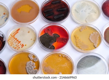 COLLECTION OF PETRI DISHES CONTAIN GROWTH OFBACTERIAL AND FUNGAL CELLS
