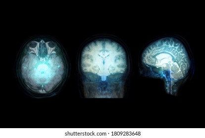 Collection transparent image of the Skull  Blue color with  MRI Brain for medical background concept.