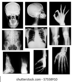  collection of x-ray