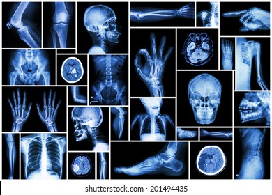 Collection X  ray multiple part human