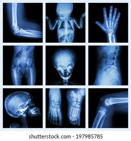 Collection X-ray part of child