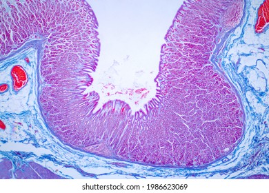 Colon Biopsy From The Colonoscopy. The Pathology Report Describes Normal Colonic Mucosa Fragment With Colic Glands. Haematoxylin And Eosin Staining Technique Slide.