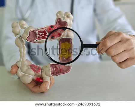 Colon model with different diseases in doctors hands