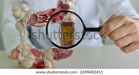 Colon model with different diseases in doctors hands