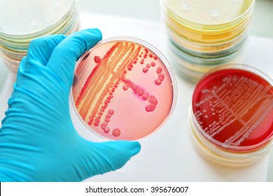 Colonies Of Bacteria In Culture Medium Plate
