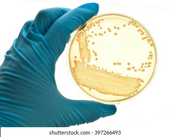 Colonies Of Bacteria In Culture Medium Plate
