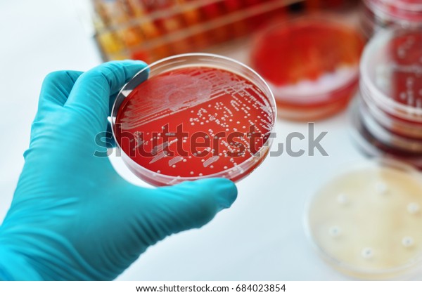 Colonies of\
bacteria in petri dish (blood\
agar)\
