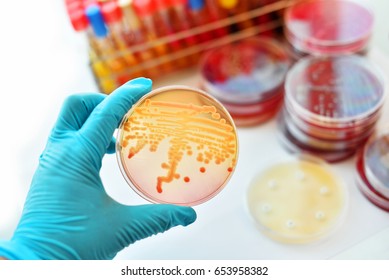 104 Klebsiella on macconkey agar Images, Stock Photos & Vectors ...