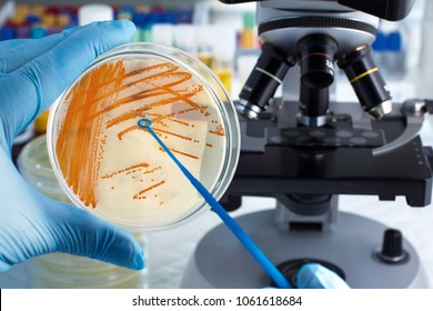 Colonies of bacteria Streptococcus agalactiae in culture medium plate / hand of technician holding plate with bacterial colonies of Streptococcus agalactiae and microscope in background