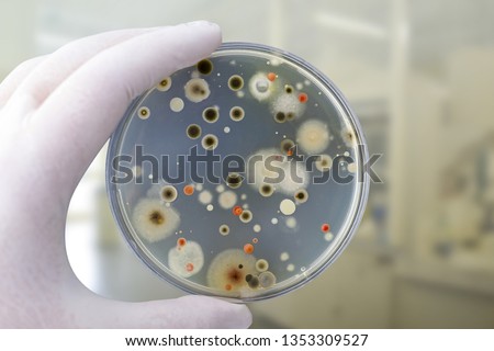 Colonies of different bacteria and mold fungi grown on Petri dish with nutrient agar, close-up view. Hand in white glove holding plate with nutrient medium in research laboratory