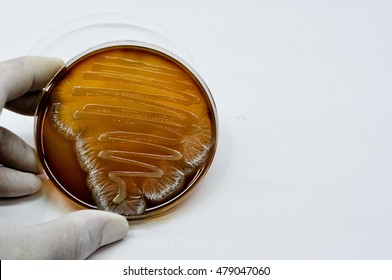 Colonies Of Fungus Spore Culture On Blood Agar Plate Close Up Contains Small Light Grains In Experimental Laboratory  Microbiology Hospital White Background