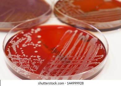 Colonies Of Gram Negative Bacteria Growing On The Culture Plate.