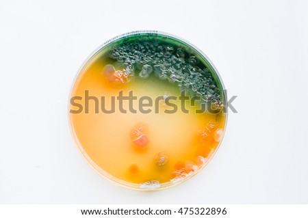 Colonies of green bacteria culture MacConkey agar plate close up contains small light grains in experimental laboratory  Hospital white background