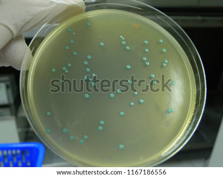 ฺBlue-green colonies of Listeria on Aloa agar plate, cultured by spread plate method.