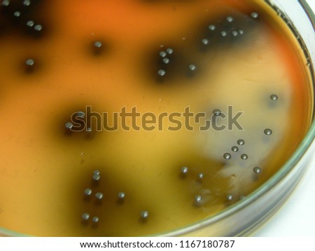Colonies of Listeria spp. on palcam medium plate