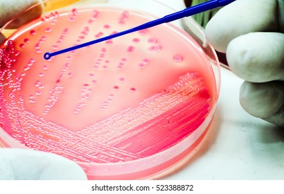 Colonies Of Red Bacteria Ferment Lactose Culture On MacConkey Agar In Microbiology Department Hospital For Experiment Glasses On White Background