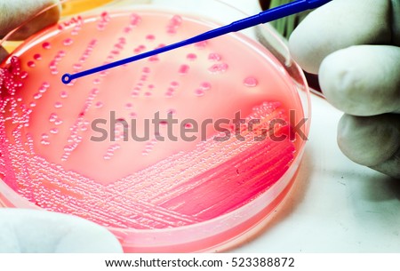 Colonies of Red Bacteria ferment lactose culture on MacConkey agar in microbiology department hospital for experiment glasses on white background
